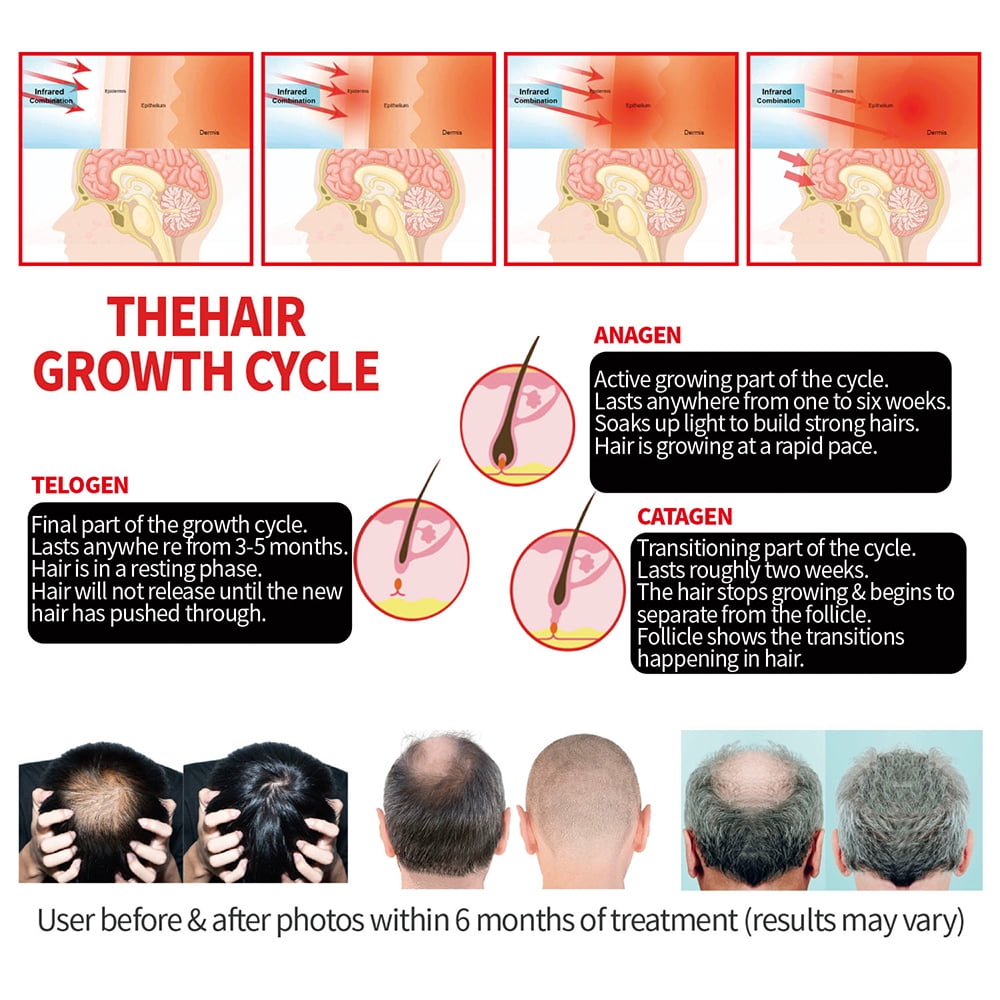 JahyShow Infrared Red Light Therapy Cap Fast Hair Regrowth Treatment Hat For Hair Loss(Black) - Image 5