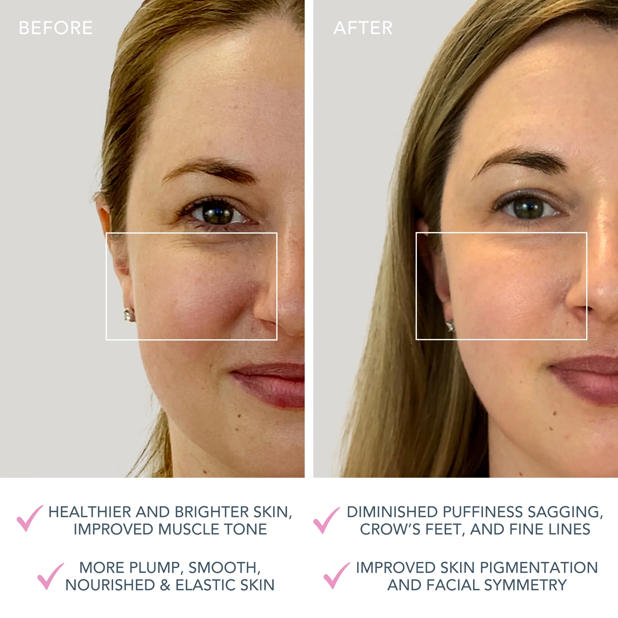 FOREO BEAR Mini Pearl Pink - Image 7