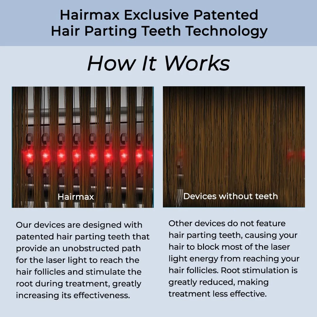 Hairmax Ultima 12 LaserComb- (FDA Cleared) Laser Hair Regrowth Treatment Device for Men & Women - Reverses Thinning Hair Loss - Red Light Therapy to Stimulate Hair Growth - Cordless Design - Image 9