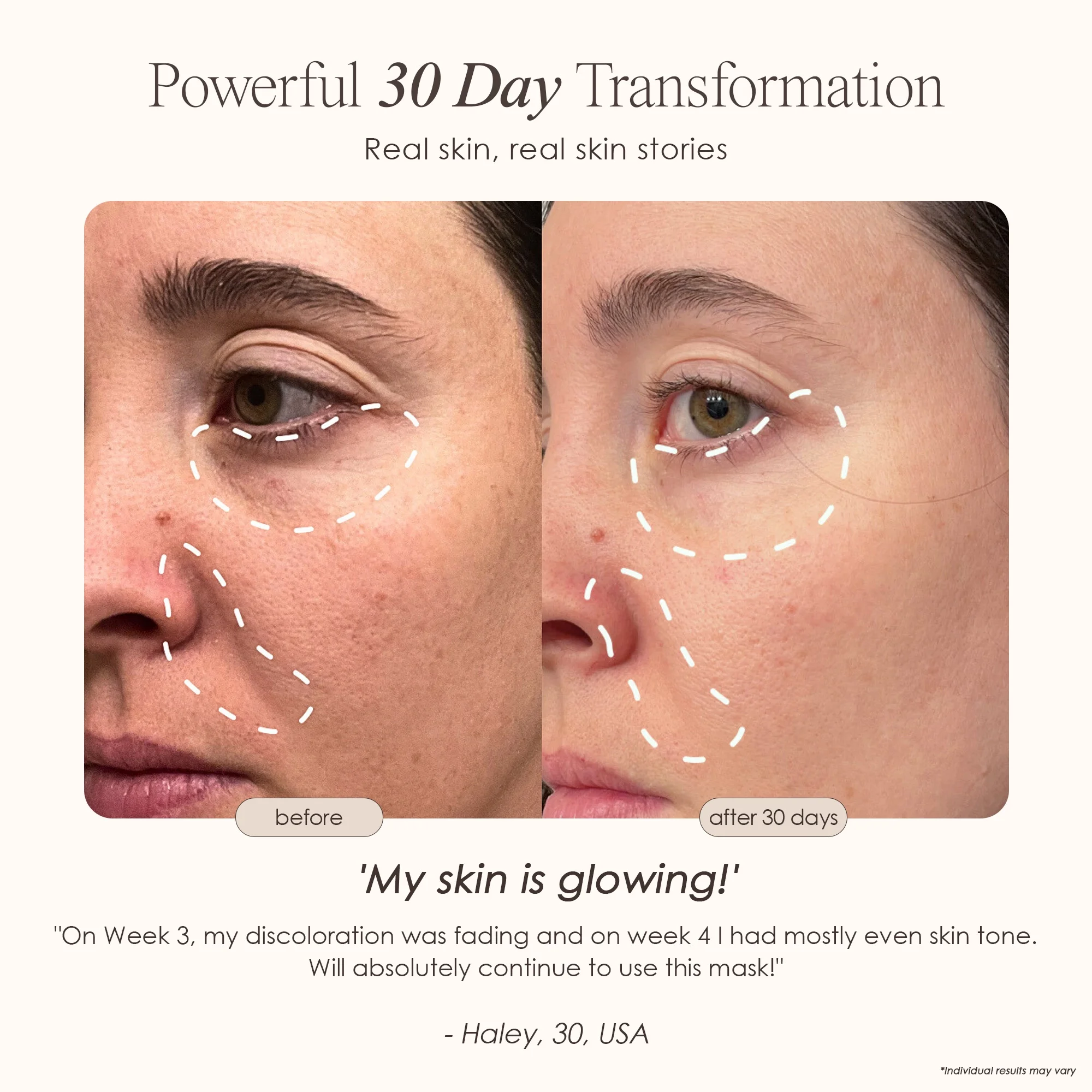 Project E Beauty LED Light Therapy Mask - Image 5