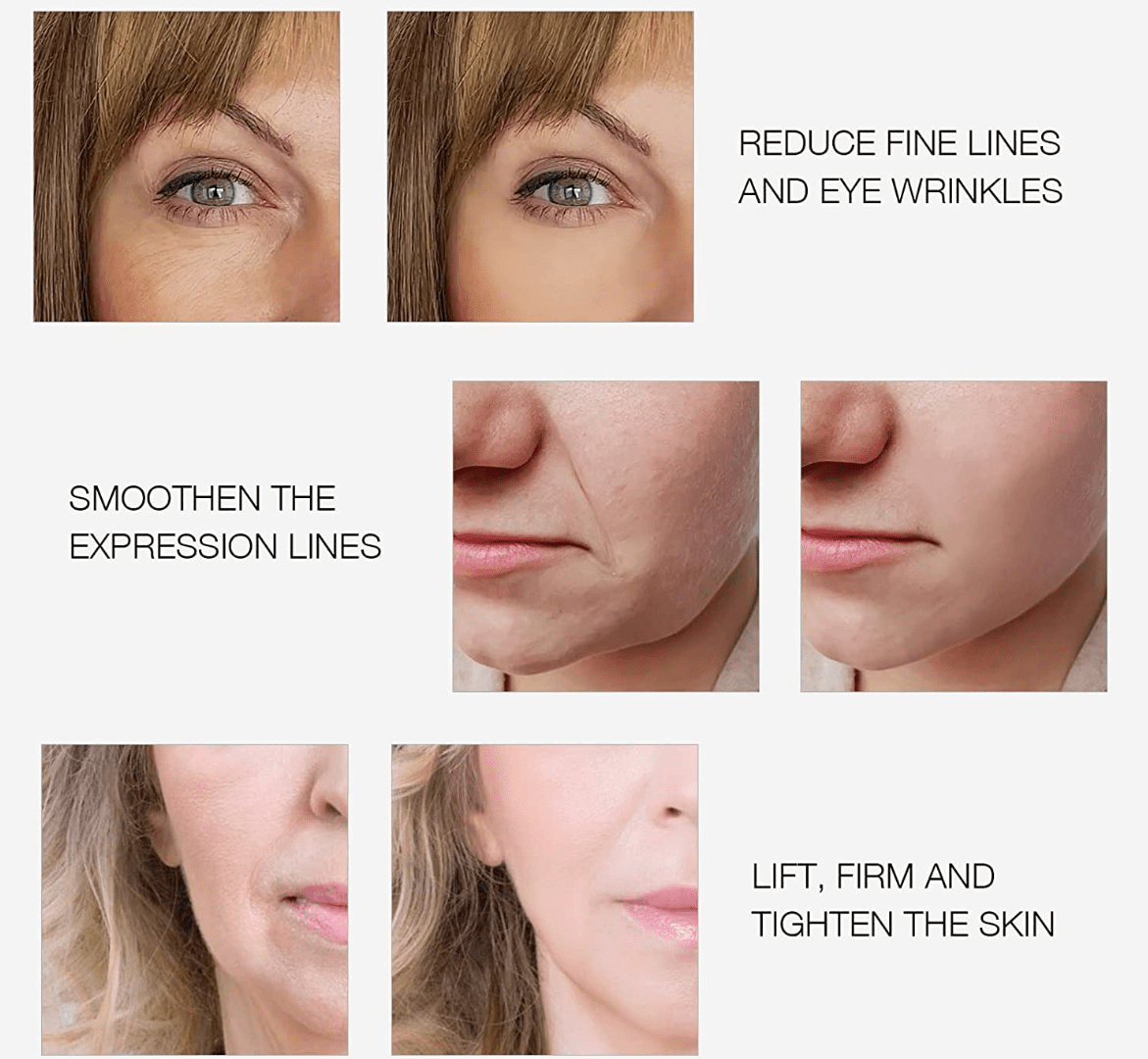 RF Radio Frequency Facial And Body Skin Tightening Machine,Professional Home RF Skin Care Anti Aging Device - Image 6