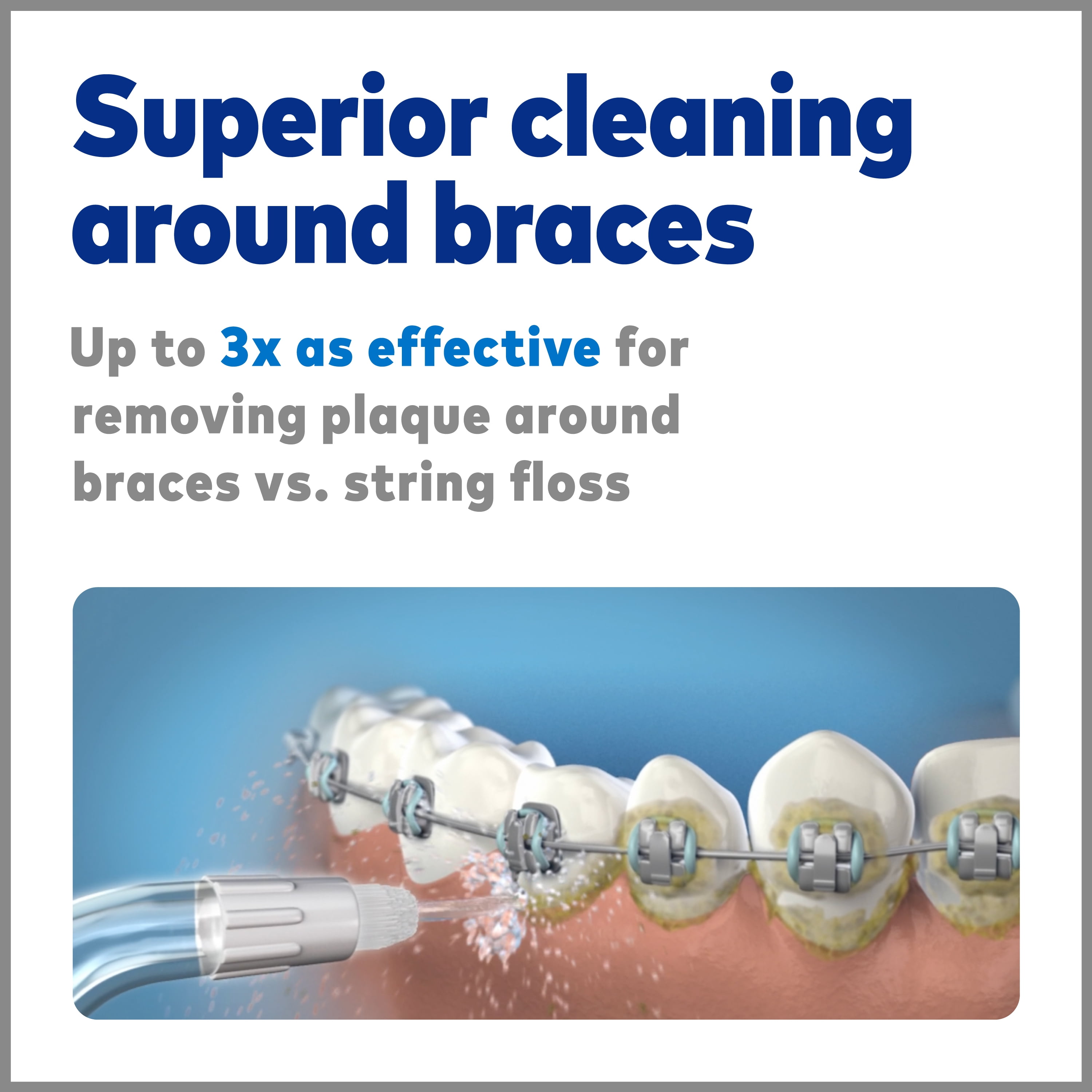 Waterpik Complete Care 5.0 Water Flosser + Sonic Toothbrush, Black - Image 12