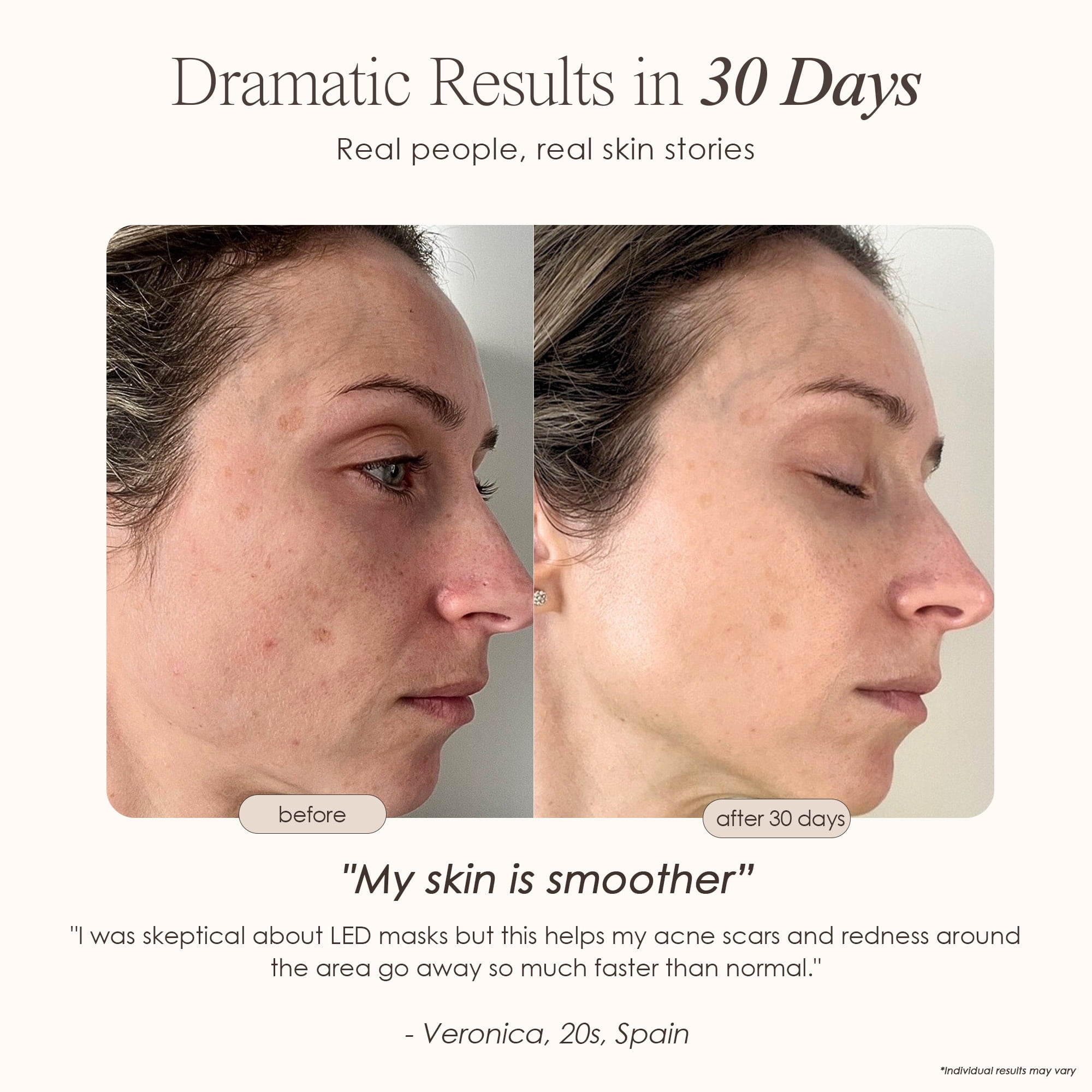 Project E Beauty Wireless 7 Color LED Mask Neck Photon Light Skin Rejuvenation Therapy Facial Skin Care Mask - Image 2