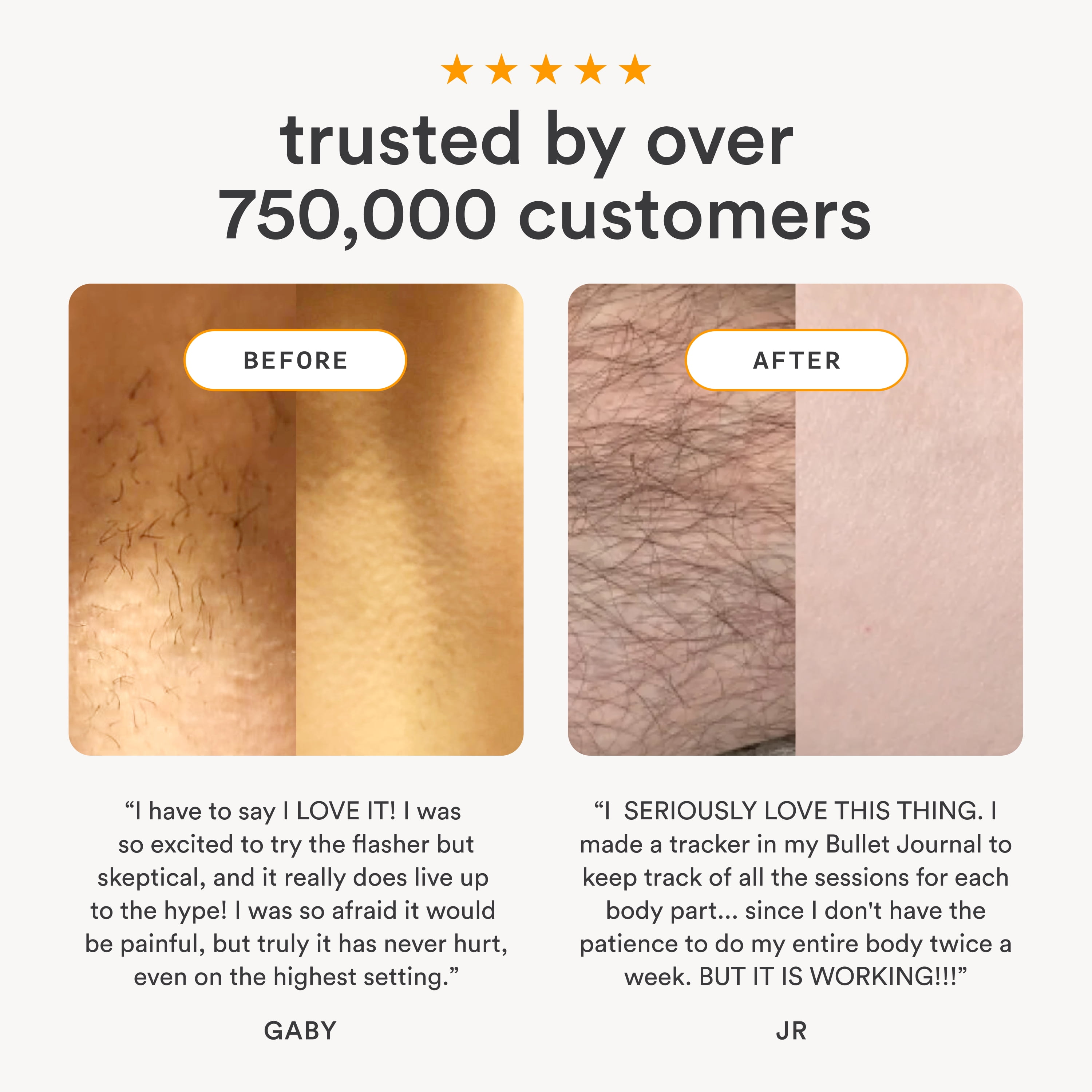 Nood Flasher 2.0 — IPL Laser Hair Removal Device for Women & Men — Pain-Free & Permanent Results - Image 2