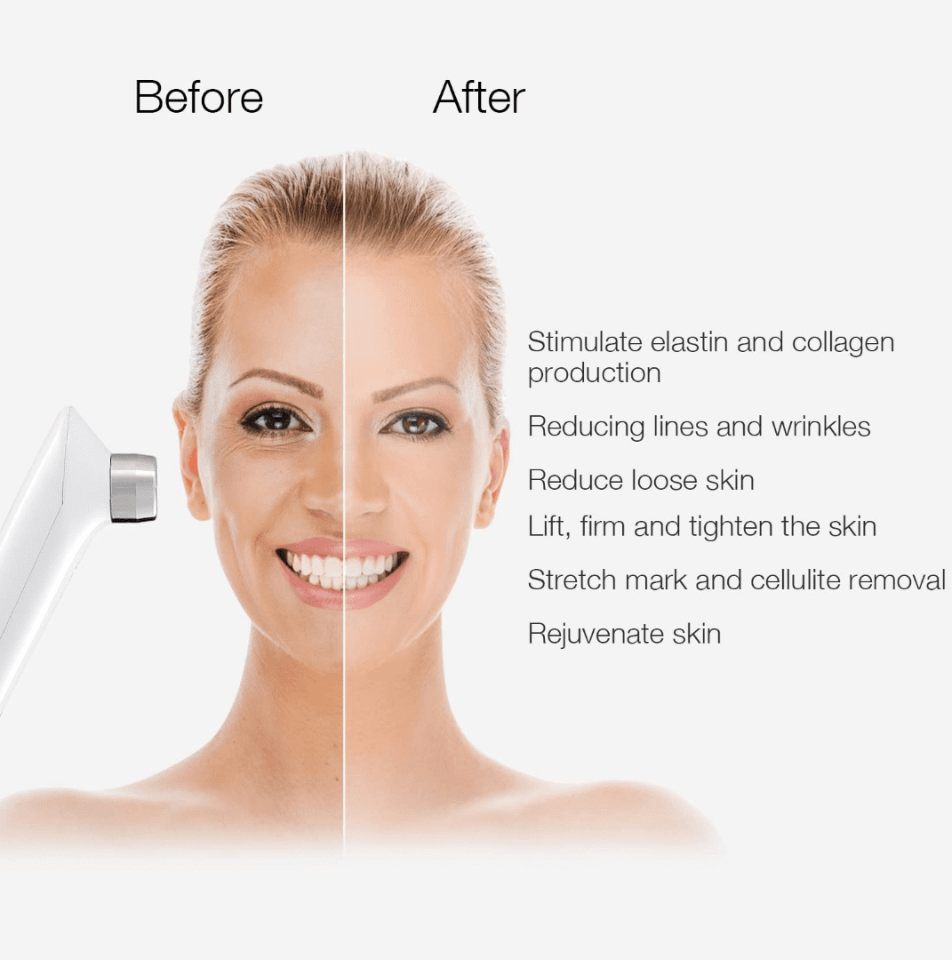 RF Radio Frequency Facial And Body Skin Tightening Machine,Professional Home RF Skin Care Anti Aging Device - Image 7